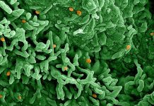 La Organización Mundial de la Salud declara la mpox una emergencia de salud pública internacional