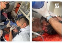 Atienden UMPC de Villa de Álvarez y CRUM atropellamiento de ciclista en el Libramiento Sur de Colima