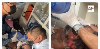 Atienden UMPC de Villa de Álvarez y CRUM atropellamiento de ciclista en el Libramiento Sur de Colima