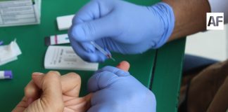 Tienen control virológico 95% de pacientes con VIH en el estado: Salud Colima