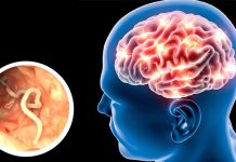 Investigadores de la UNAM y UAM desarrollan «escudos» moleculares contra la cisticercosis