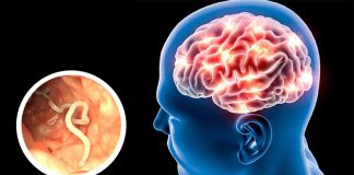 Investigadores de la UNAM y UAM desarrollan «escudos» moleculares contra la cisticercosis