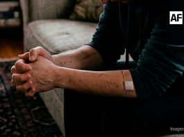 Autolesiones en jóvenes: llamado a detectar señales de alarma y buscar ayuda profesional