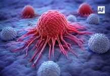 El cáncer no debe abordarse desde el miedo, sino desde la acción; la detección temprana puede salvar vidas: Especialista Eduardo Peña