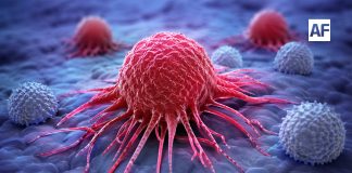 El cáncer no debe abordarse desde el miedo, sino desde la acción; la detección temprana puede salvar vidas: Especialista Eduardo Peña