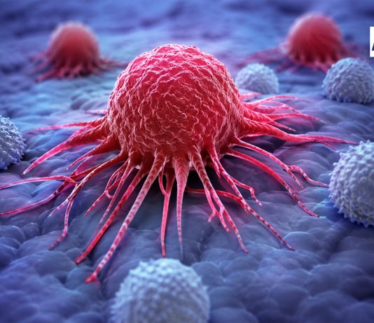 El cáncer no debe abordarse desde el miedo, sino desde la acción; la detección temprana puede salvar vidas: Especialista Eduardo Peña