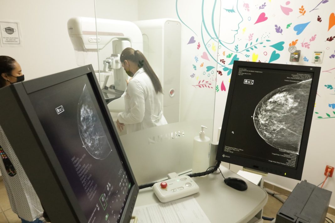mastografias gratuitas 04