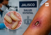 Confirman primer caso de gusano barrenador en humanos en Pihuamo, Jalisco