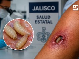 Confirman primer caso de gusano barrenador en humanos en Pihuamo, Jalisco