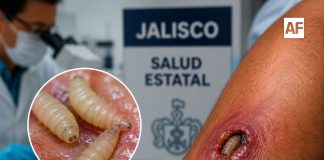 Confirman primer caso de gusano barrenador en humanos en Pihuamo, Jalisco