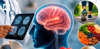 IMSS llama a cuidar la salud cerebral con hábitos saludables y atención médica oportuna