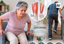 ¿Te cuesta levantarte de una silla o subir escaleras? Podrían ser señales de sarcopenia