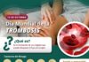 Trombosis: el peligro de un coágulo que puede poner en riesgo la vida; IMSS Colima explica cómo prevenirla