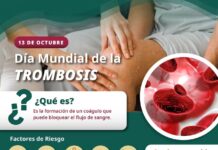 Trombosis: el peligro de un coágulo que puede poner en riesgo la vida; IMSS Colima explica cómo prevenirla
