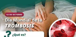 Trombosis: el peligro de un coágulo que puede poner en riesgo la vida; IMSS Colima explica cómo prevenirla