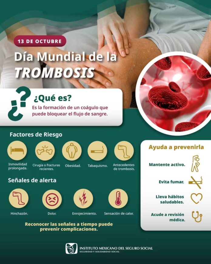 imss trombosi